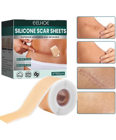 Silicone Scar Sheets