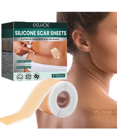 Silicone Scar Sheets