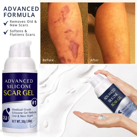 Advanced™ Scar Removal Gel