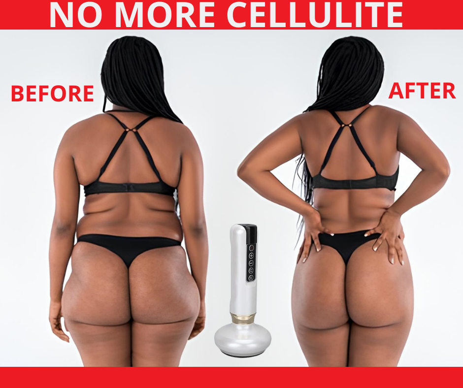 Anti Cellulite Massager