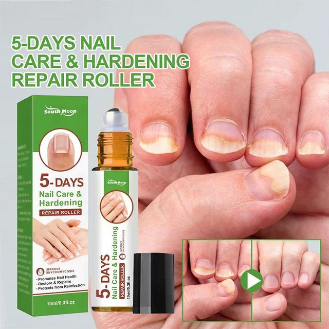 5 Days Nail Repair Roller