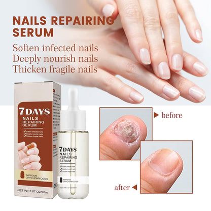 7 Days nails repairing Serum